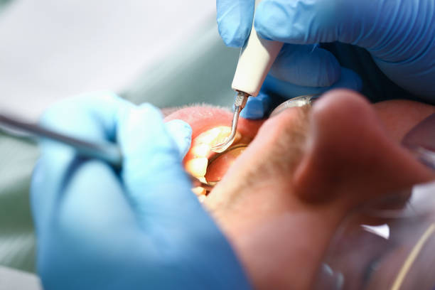 Best Urgent Dental Care for Toothache in New Town, ND